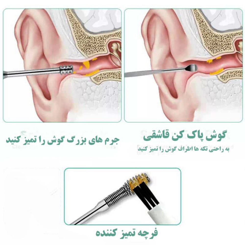 ست گوش پاک کن فلزی فنری